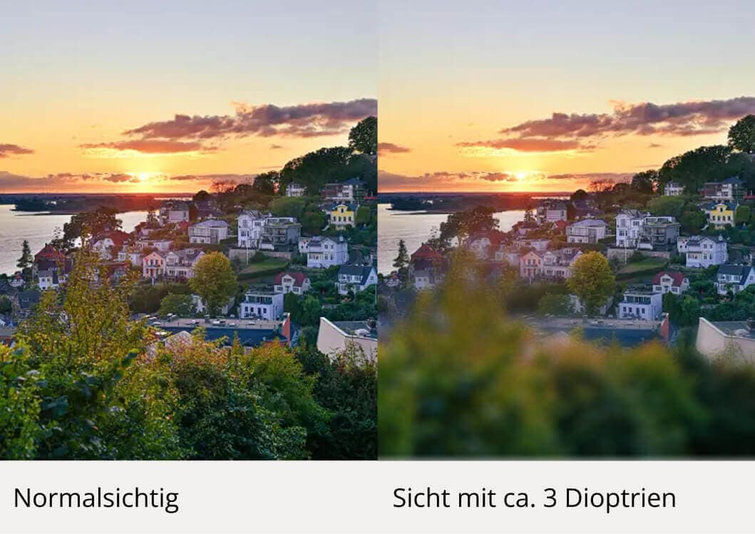 Weitsichtigkeit-Sicht-2
