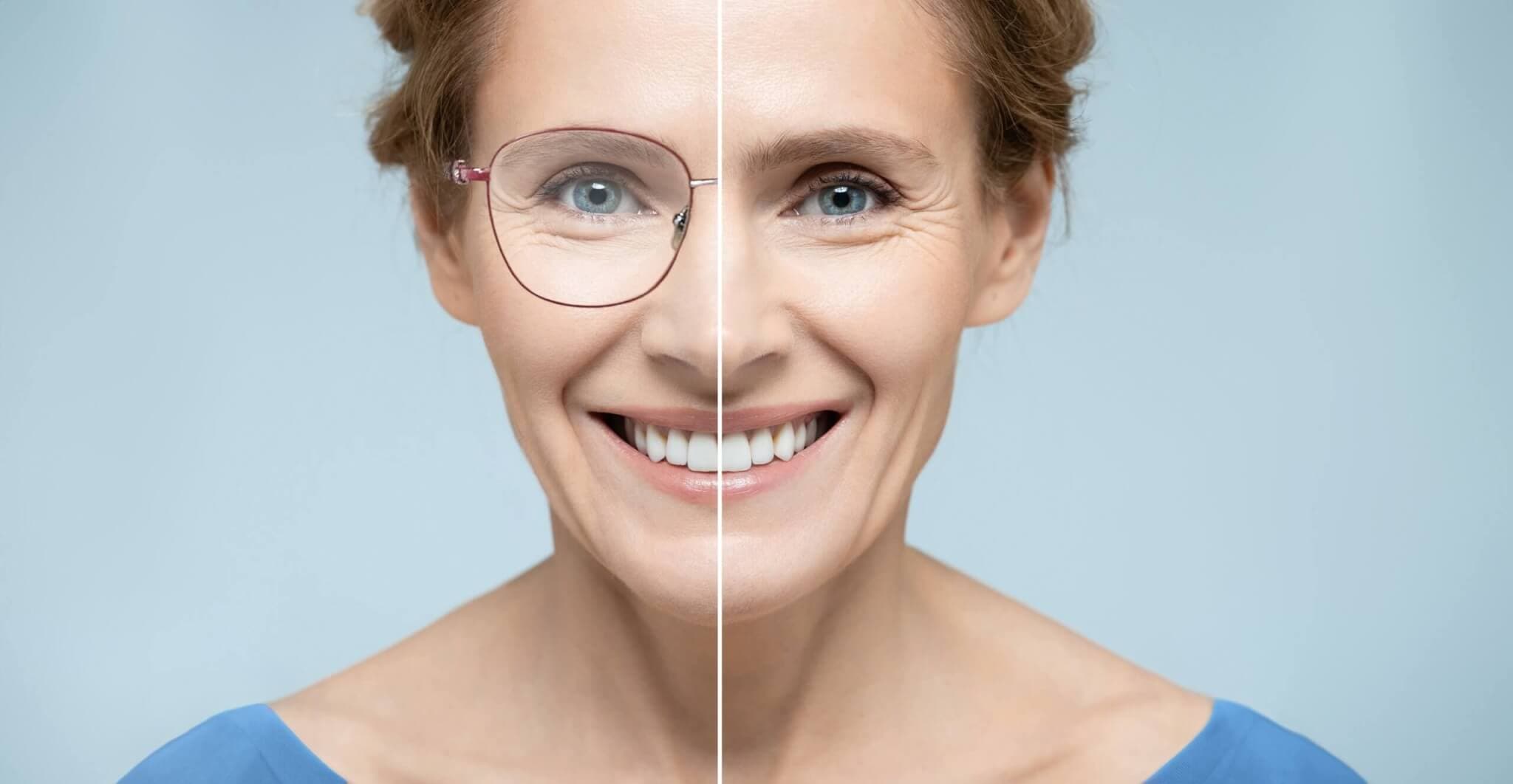 Augenlaser Methoden Frau mit halber Brille