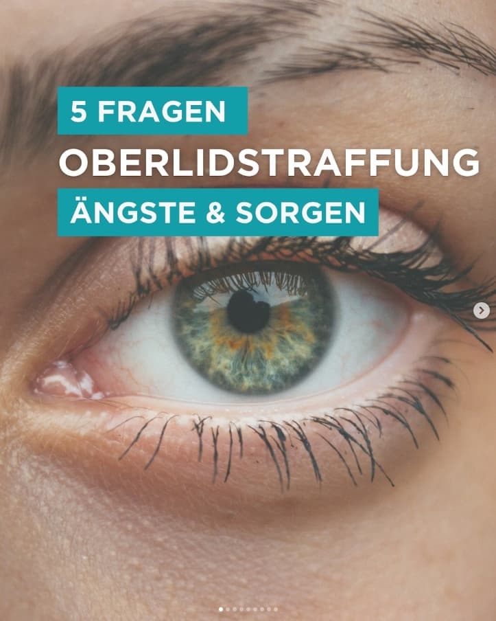Instagram: 5 Fragen Oberlidstraffung